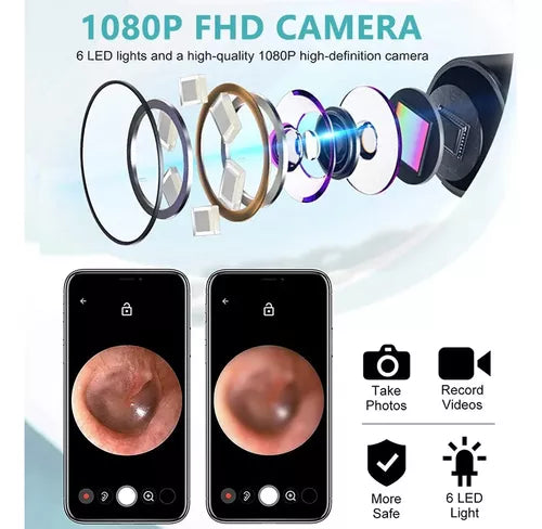 Kit De Limpieza De Oídos Con Cámara Otoscopio 1080p Wifi