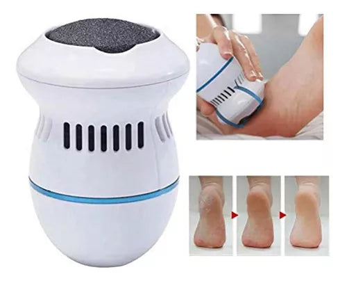 Removedor De Callos Exfoliador Limpieza Pies Suaves Usb Color Blanco