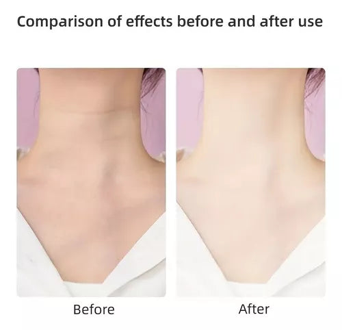 Aparato Rejuvenecedor Facial Y De Cuello Masajes Vibración Color Rosa claro