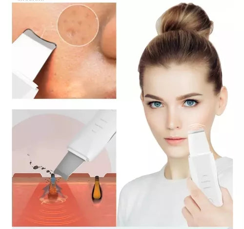 Paleta Limpiador Ultrasónico Facial Digital Peeling Lifting