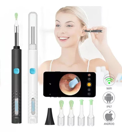 Kit De Limpieza De Oídos Con Cámara Otoscopio 1080p Wifi Color Blanco