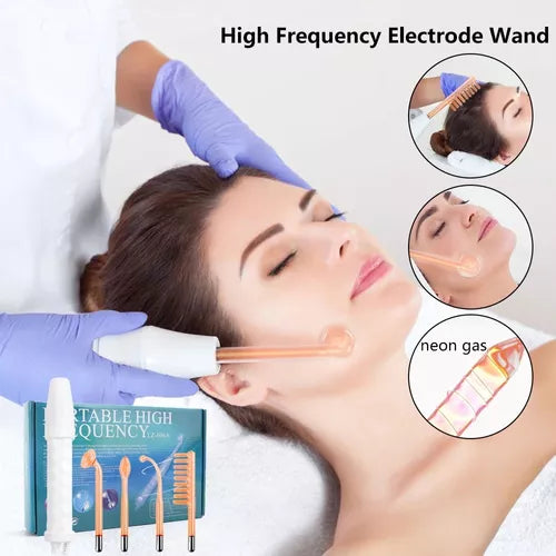 Removedor De Manchas 4 En 1 Alta Radiofrecuencia Facial