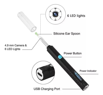 Kit De Limpieza De Oídos Con Cámara Otoscopio 1080p Wifi Color Blanco
