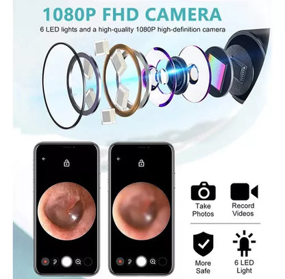 Kit De Limpieza De Oídos Con Cámara Otoscopio 1080p Wifi Color Blanco