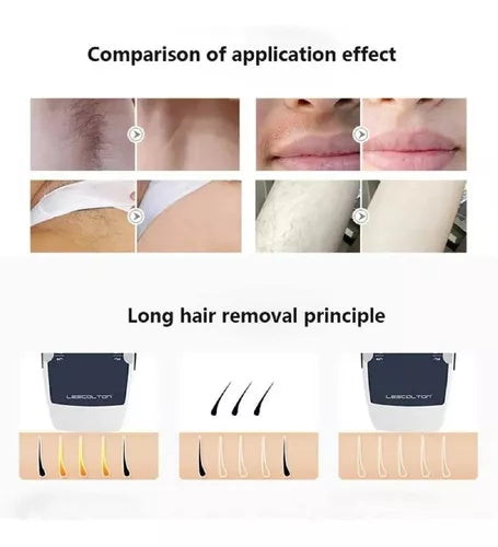 Depiladora Ipl Maquina Depiladora Definitiva Laser